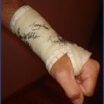 cast2-wrist.jpg