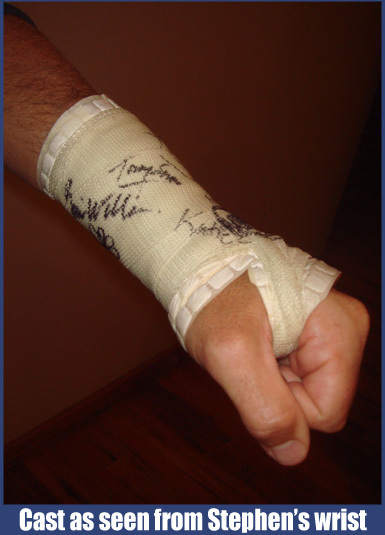 cast2-wrist.jpg